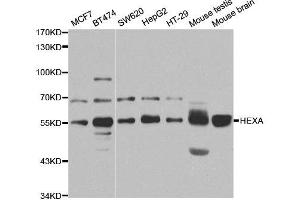 Western Blotting (WB) image for anti-Hexosaminidase A (HEXA) antibody (ABIN1876847) (Hexosaminidase A anticorps)