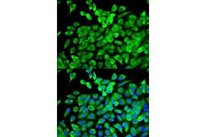 Immunofluorescence analysis of MCF-7 cells using EIF4A1 antibody. (EIF4A1 anticorps  (AA 1-406))