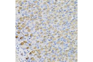 Immunohistochemistry of paraffin-embedded mouse stomach using LDHB antibody (ABIN5975613) at dilution of 1/100 (40x lens). (LDHB anticorps)