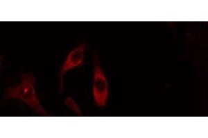 ABIN6275086 staining Hela cells by IF/ICC. (DZIP3 anticorps  (Internal Region))