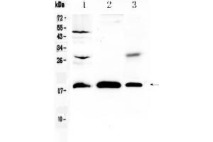 Western blot analysis of TMEM240 using anti- TMEM240 antibody . (TMEM240 anticorps  (AA 1-173))