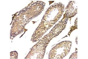IHC analysis of WWOX using anti-WWOX antibody (ABIN6719627). (WWOX anticorps  (AA 1-245))