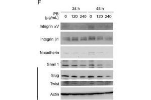 PB downregulates several proteins related to cell cycle progression, morphology, cell-cell adhesion and cell migration.