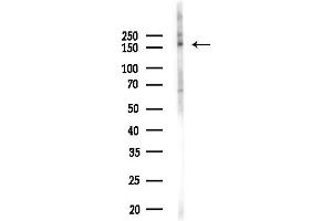 anti-Small Nuclear RNA Activating Complex, Polypeptide 4, 190kDa (SNAPC4) (N-Term) antibody