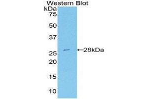 Western Blotting (WB) image for anti-DEAD (Asp-Glu-Ala-Asp) Box Polypeptide 58 (DDX58) (AA 1-211) antibody (ABIN3206479) (DDX58 anticorps  (AA 1-211))
