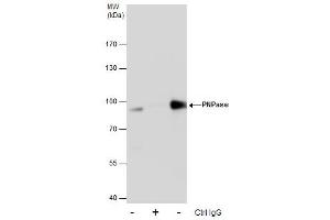 IP Image Immunoprecipitation of PNPase protein from HeLa whole cell extracts using 5 μg of PNPase antibody, Western blot analysis was performed using PNPase antibody, EasyBlot anti-Rabbit IgG  was used as a secondary reagent.
