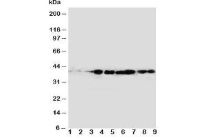 Western blot testing of CrkL antibody and rat samples 1: spleen;  2: ovary;  3: testis; and human samples 4: MM231;  5: A431;  6: MCF-7;  Lane 7;  MM231;  8: MM543;  9: Jurkat cell lysate. (CrkL anticorps  (AA 286-303))