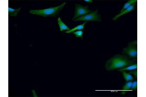Immunofluorescence of purified MaxPab antibody to BTRC on HeLa cell.