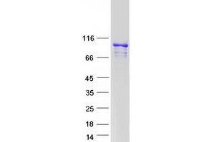 Validation with Western Blot