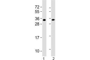 Western blot testing of 1) mouse heart and 2) rat PC-12 lysate with SLUG antibody.