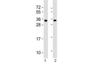 Western blot testing of 1) mouse heart and 2) rat PC-12 lysate with SLUG antibody. (SLUG anticorps  (AA 98-129))