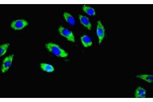 Immunofluorescent analysis of A549 cells using ABIN7167605 at dilution of 1:100 and Alexa Fluor 488-congugated AffiniPure Goat Anti-Rabbit IgG(H+L) (RGS2 anticorps  (AA 1-241))