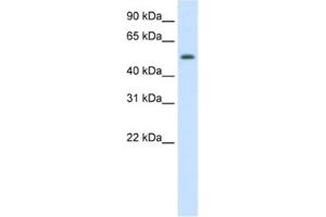 Western Blotting (WB) image for anti-Death Inducer-Obliterator 1 (DIDO1) antibody (ABIN2461922) (DIDO1 anticorps)