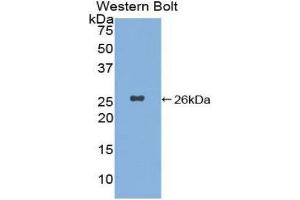 Western Blotting (WB) image for anti-Xeroderma Pigmentosum, Complementation Group C (XPC) (AA 734-933) antibody (ABIN1860965) (XPC anticorps  (AA 734-933))