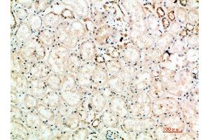 Immunohistochemical analysis of paraffin-embedded human-kidney, antibody was diluted at 1:200 (CTLA4 anticorps  (AA 41-90))