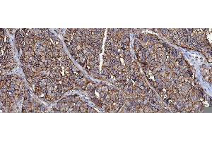 IHC analysis of CD147/Emmprin using anti-CD147/Emmprin antibody (ABIN7599998).