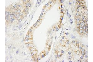 Immunohistochemistry (IHC) image for anti-C2 Calcium Dependent Domain Containing 5 (C2CD5) (AA 375-425) antibody (ABIN7448623) (C2CD5/KIAA0528 anticorps  (AA 375-425))