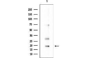 anti-Transmembrane Protein 107 (TMEM107) antibody