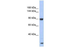 URG4 antibody used at 1 ug/ml to detect target protein.