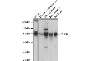 Western blot analysis of extracts of various cell lines, using STK38L Rabbit pAb (ABIN7270226) at 1:1000 dilution. (STK38L anticorps  (AA 165-464))