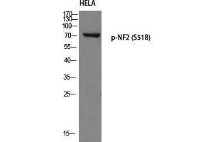 Western Blot (WB) analysis of HeLa using p-NF2 (S518) antibody. (Merlin anticorps  (pSer518))