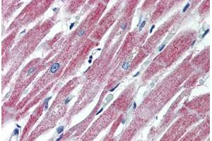 anti-MAS1 Oncogene (MAS1) (AA 187-236) antibody