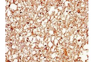 IHC image of ABIN7144516 diluted at 1:370 and staining in paraffin-embedded human brain tissue performed on a Leica BondTM system.