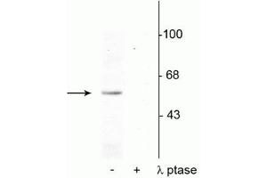 Western blot of rat brain nuclear fraction lysate showing specific immunolabeling of the ~53 kDa p53 phosphorylated at Ser392 in the first lane (-). (p53 anticorps  (pSer392))
