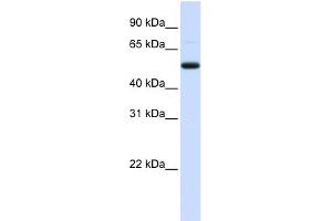 WB Suggested Anti-DCP2 Antibody Titration:  0. (DCP2 anticorps  (Middle Region))