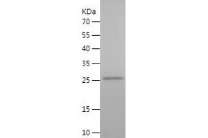 Western Blotting (WB) image for Phosphogluconate Dehydrogenase (PGD) (AA 33-259) protein (His tag) (ABIN7124412)