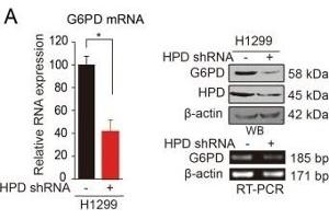 HPD contributes to cell proliferation through upregulation of G6PD. (HPD anticorps)