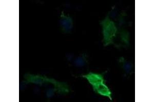 Image no. 1 for anti-Mitogen-Activated Protein Kinase Kinase 1 (MAP2K1) antibody (ABIN1499375)