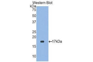 Western Blotting (WB) image for anti-Retinoic Acid Receptor Responder (Tazarotene Induced) 2 (RARRES2) (AA 21-155) antibody (ABIN1858397) (Chemerin anticorps  (AA 21-155))