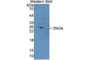 Western Blotting (WB) image for anti-Formin Binding Protein 1 (FNBP1) (AA 348-529) antibody (ABIN1868017)