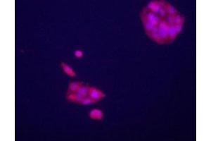 Immunofluorecence staining of GPC3 antibody on HepG2 cells.