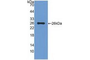 Detection of Recombinant TIGIT, Rat using Polyclonal Antibody to T-Cell Immunoreceptor With Ig And ITIM Domains Protein (TIGIT)