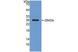 Detection of Recombinant TIGIT, Rat using Polyclonal Antibody to T-Cell Immunoreceptor With Ig And ITIM Domains Protein (TIGIT) (TIGIT anticorps  (AA 28-227))