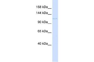 PTCH2 antibody used at 1 ug/ml to detect target protein. (Patched 2 anticorps)