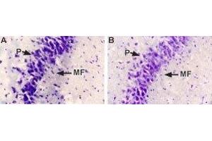 Expression of NGF in rat brain - Immunohistochemical staining of rat hippocampal mossy fiber terminal zone using Anti-NGF Antibody (#AN-240). (Nerve Growth Factor anticorps)