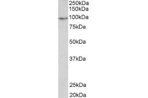 ABIN5539878 2µg/ml) staining of Human Uterus lysate (35µg protein in RIPA buffer). (PDE4B anticorps  (C-Term))