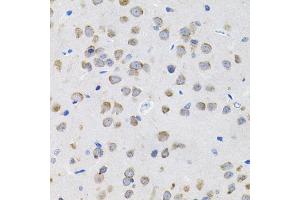 Immunohistochemistry of paraffin-embedded rat brain using IL13 antibody (ABIN3022881, ABIN3022882, ABIN3022883 and ABIN6219278) (40x lens).