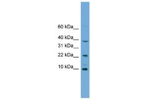 WB Suggested Anti-CHCHD8 Antibody Titration: 0. (COA4 anticorps  (Middle Region))