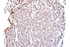IHC-P Image Immunohistochemical analysis of paraffin-embedded SW480 xenograft, using TEAD4, antibody at 1:500 dilution. (TEAD4 anticorps  (Center))