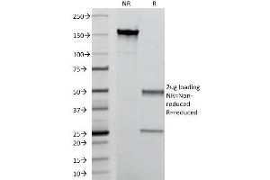 SDS-PAGE Analysis Purified Macrophage L1 Protein Mouse Monoclonal Antibody (MAC387). (S100A8 anticorps)