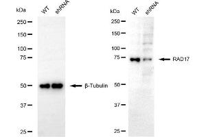 Western blotting analysis using RAD17 antibody (ABIN7800114). (RAD17 anticorps)