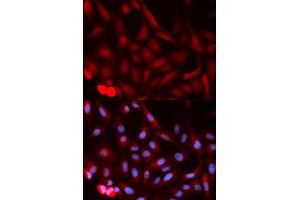Immunofluorescence (IF) image for anti-Proteasome (Prosome, Macropain) Activator Subunit 1 (PA28 Alpha) (PSME1) antibody (ABIN1876546) (PSME1 anticorps)