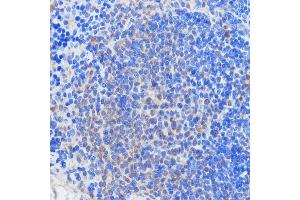 Immunohistochemistry of paraffin-embedded mouse spleen using RBM39 antibody (ABIN7270085) at dilution of 1:100 (40x lens).