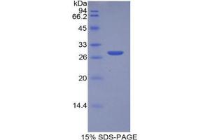 SDS-PAGE analysis of Human MPST Protein. (MPST Protéine)