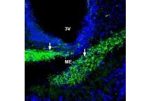 Expression of ZIP6 in rat hypothalamus - Immunohistochemical staining of perfusion-fixed frozen rat brain sections with Anti-ZIP6/SLC39A6 (extracellular) Antibody (ABIN7043725, ABIN7045348 and ABIN7045349), (1:200), followed by goat anti-rabbit-AlexaFluor-488.
