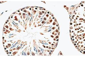 Immunohistochemistry of paraffin-embedded Mouse testis using CBX6 Polyclonal Antibody at dilution of 1:100 (40x lens). (CBX6 anticorps)